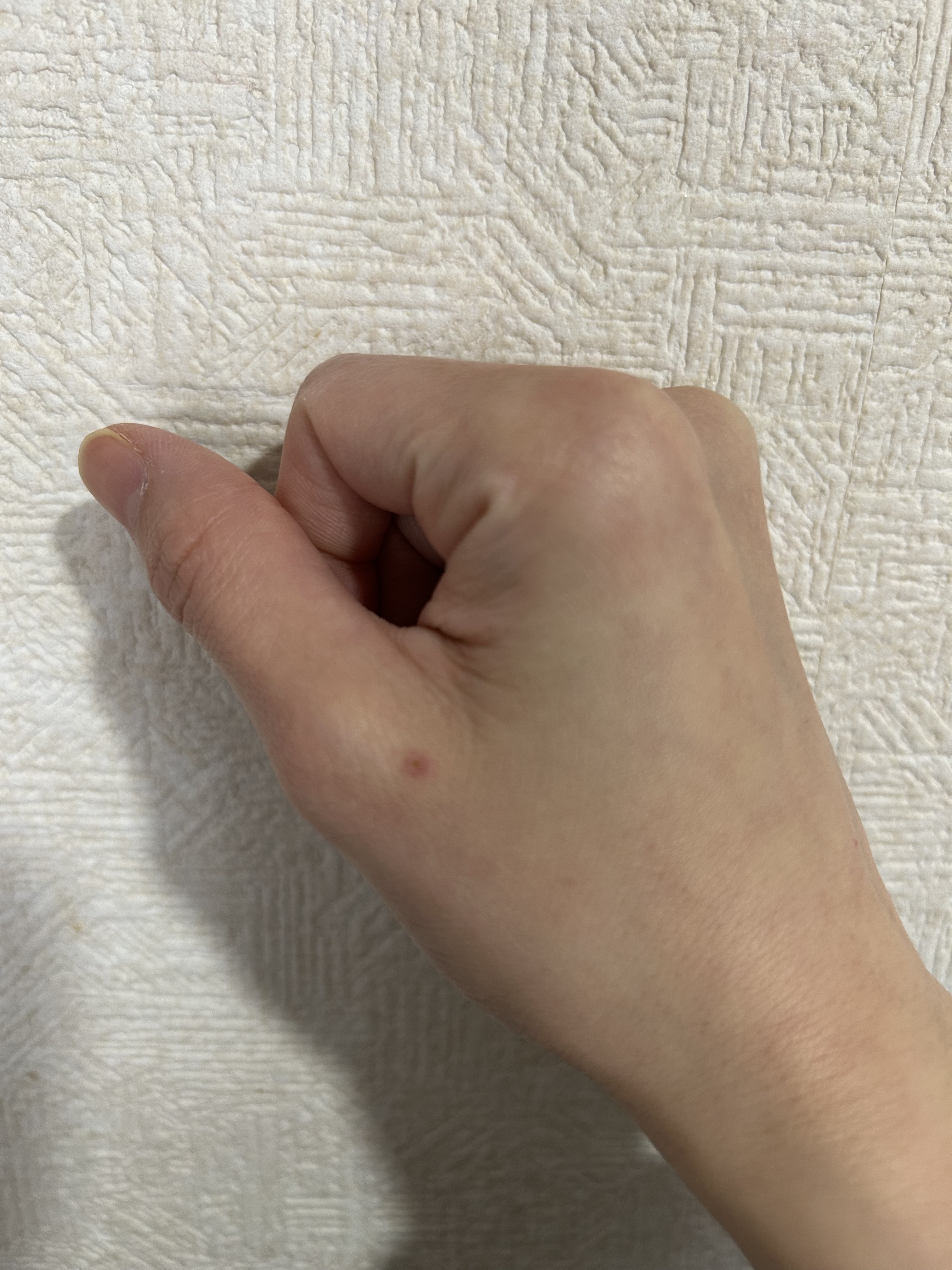 クリアパッチ/Angelab/にきびパッチを使ったクチコミ（2枚目）