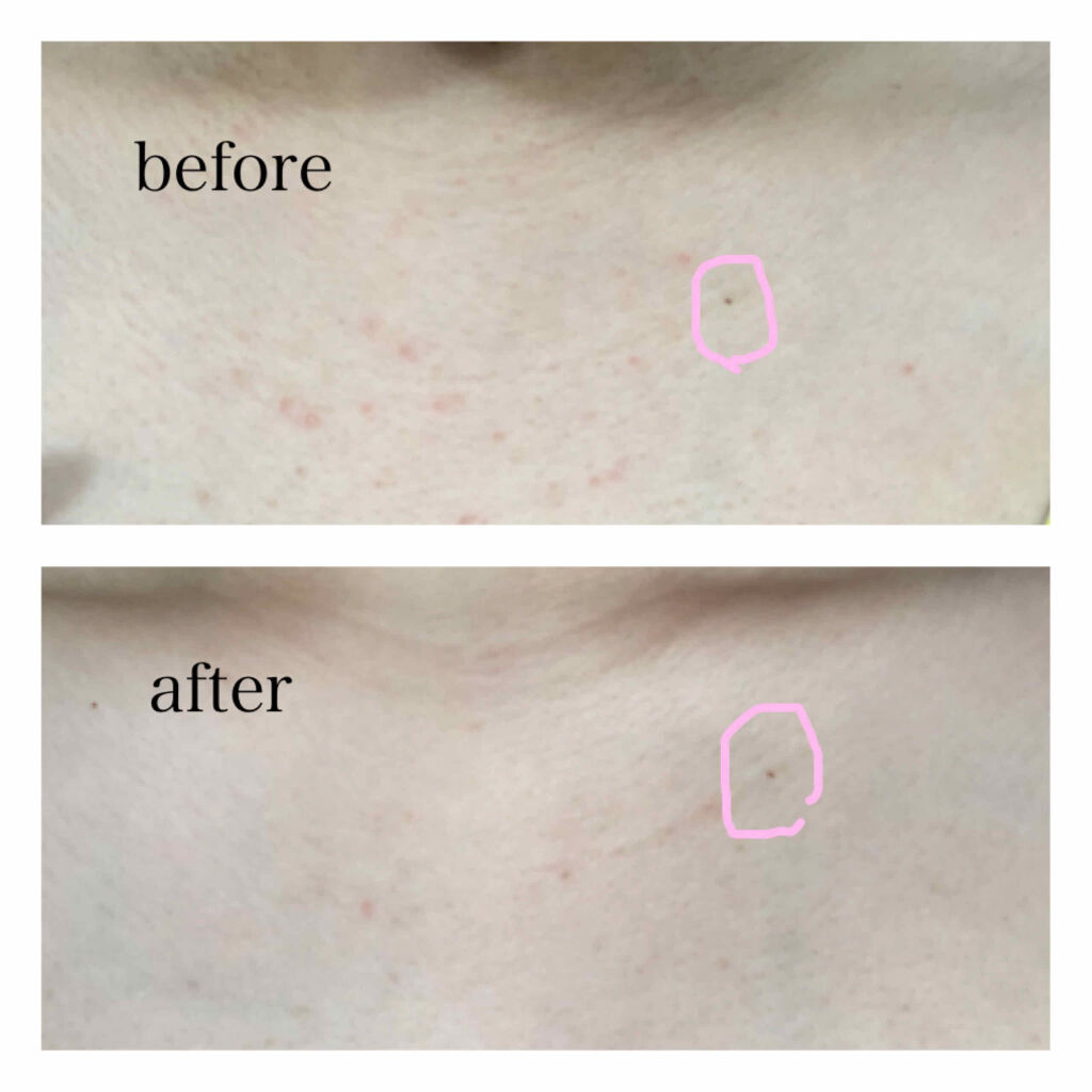 化粧水・敏感肌用・しっとりタイプ/無印良品/化粧水を使ったクチコミ（2枚目）