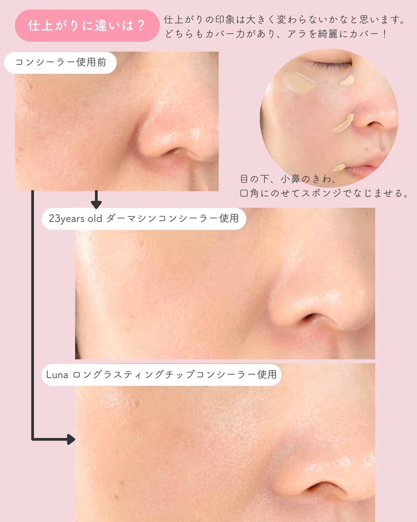 ロングラスティングチップコンシーラー/LUNA/リキッドコンシーラーを使ったクチコミ(5枚目)