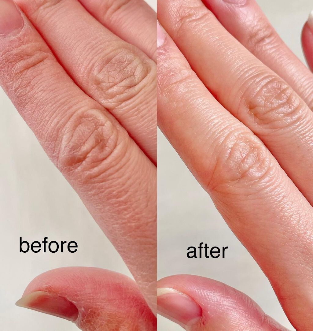 モイスチュア ハンドクリーム/カルテHD/ハンドクリームを使ったクチコミ(3枚目)