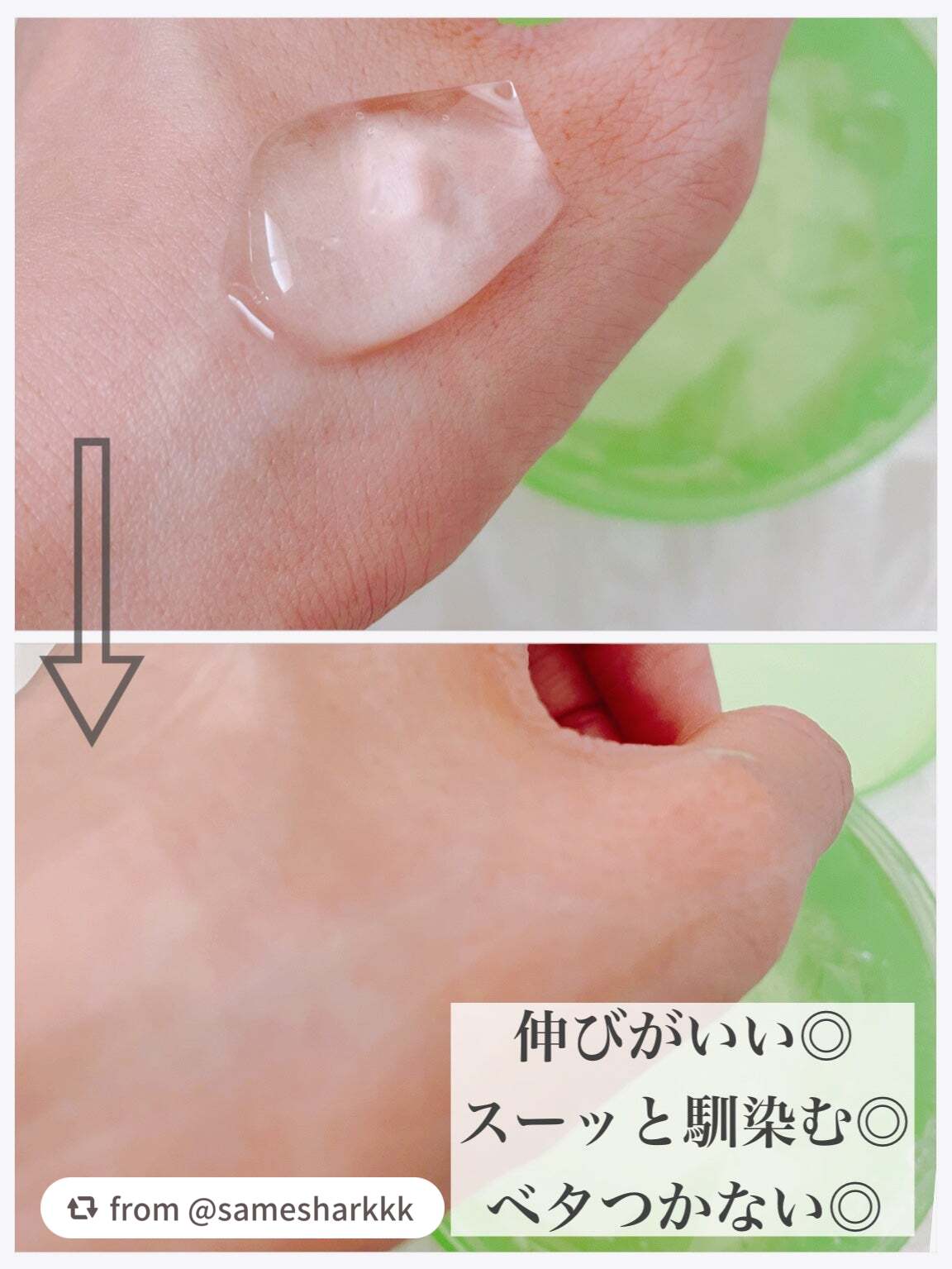 ティーツリーカーミングハイドロジェル/MEDIHEAL/ボディローションを使ったクチコミ(3枚目)