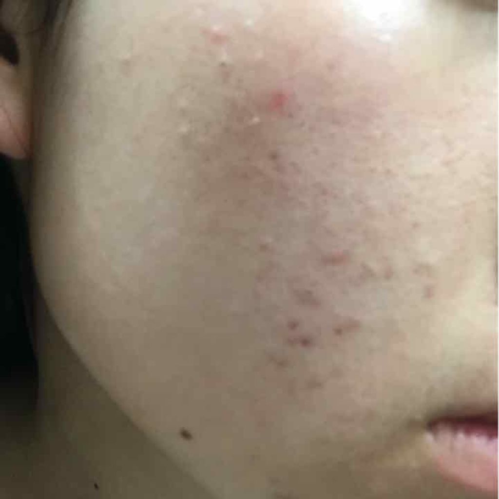 スクワビューティ 薬用素肌いきいきパック/スクワビューティー/フェイスクリームを使ったクチコミ（3枚目）