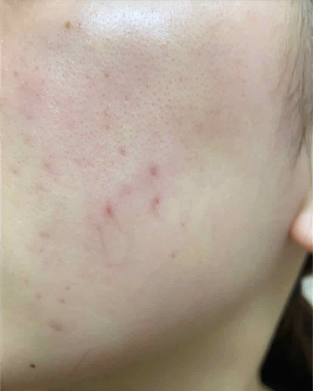 美白化粧水 VC/ちふれ/化粧水を使ったクチコミ（2枚目）