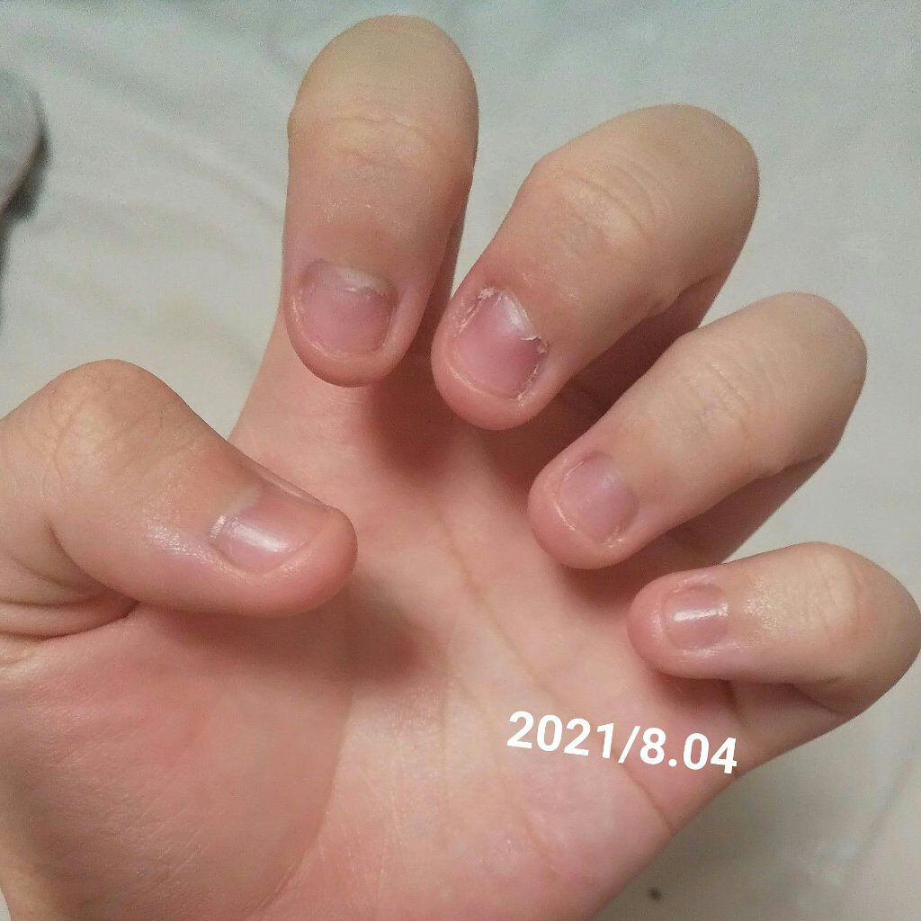 エテュセ クイックケアコート/ettusais/ネイルオイル・トリートメントを使ったクチコミ（3枚目）