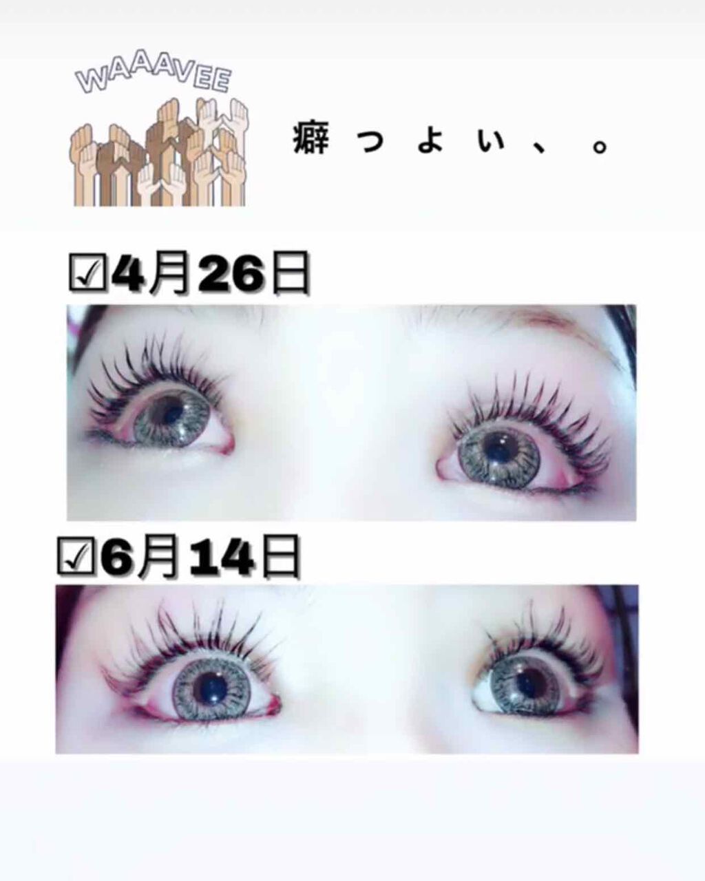 リバイタラッシュ アドバンス ジャパン/エム・アール・アイ/まつげ美容液を使ったクチコミ（2枚目）