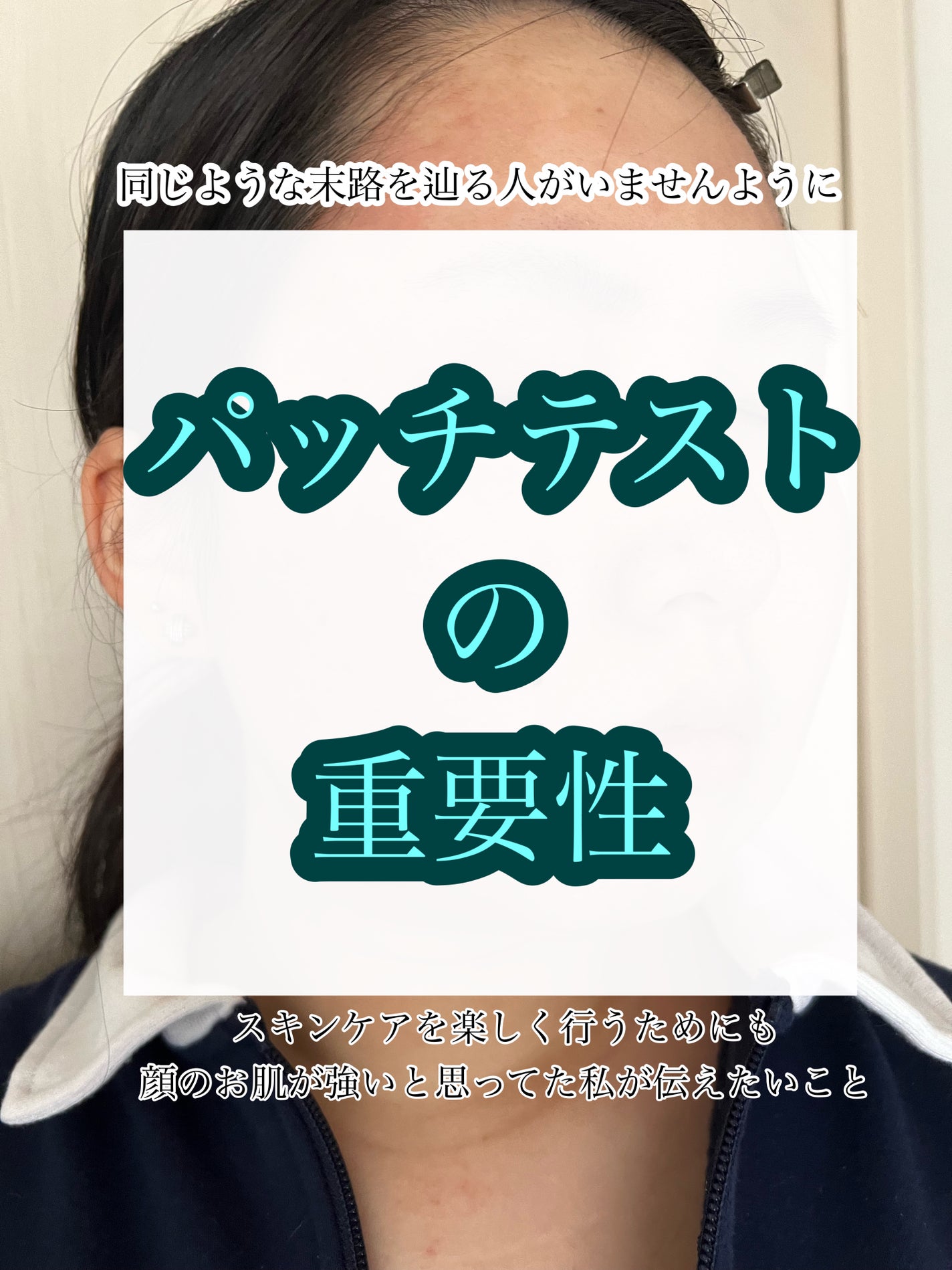 ナイちゃん on LIPS 「「季節の変わり目だし、乾燥しないようにスキンケアを見直そう!」..」(1枚目)