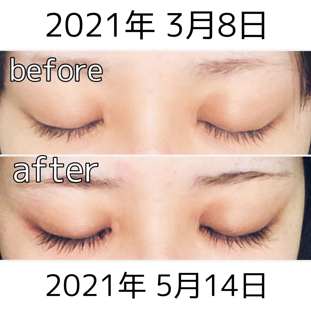 EMAKED（エマーキット）/水橋保寿堂製薬/まつげ美容液を使ったクチコミ（1枚目）