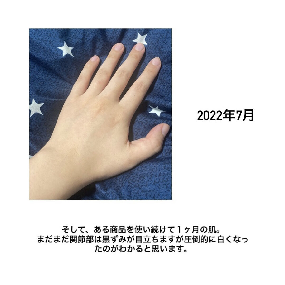 DHC ビタミンＣハードカプセル/DHC/美容サプリメントを使ったクチコミ（3枚目）