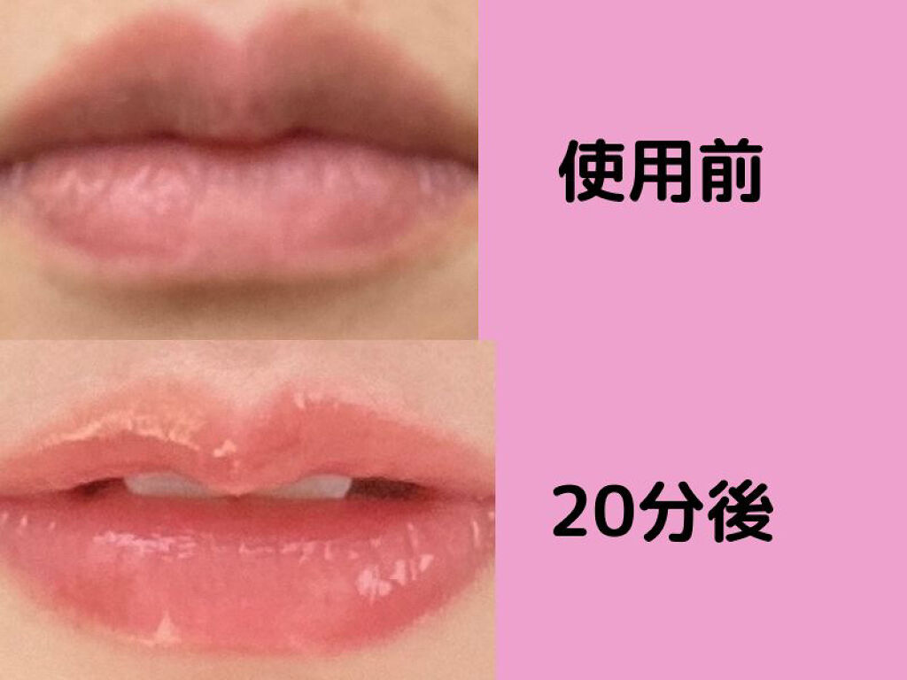 DEROLリッププランパー＆リップケアグロスセット/DEROL /リッププランパーを使ったクチコミ（2枚目）