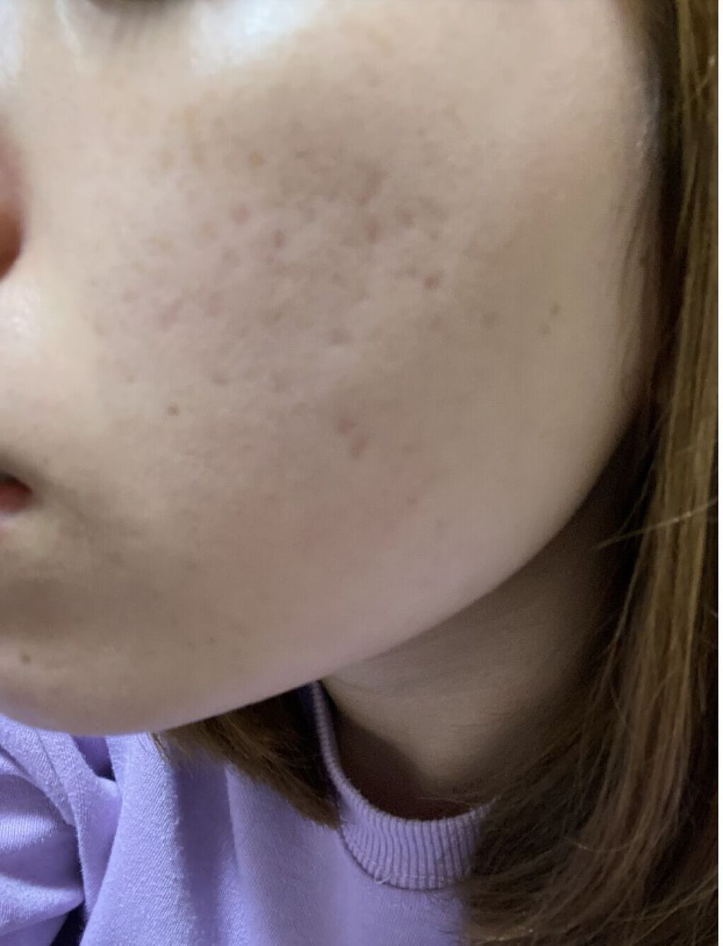 ポアナローション/DHC/化粧水を使ったクチコミ（3枚目）