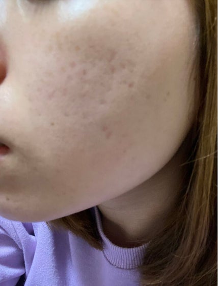 マイルドクレンジング オイル/ファンケル/オイルクレンジングを使ったクチコミ(3枚目)