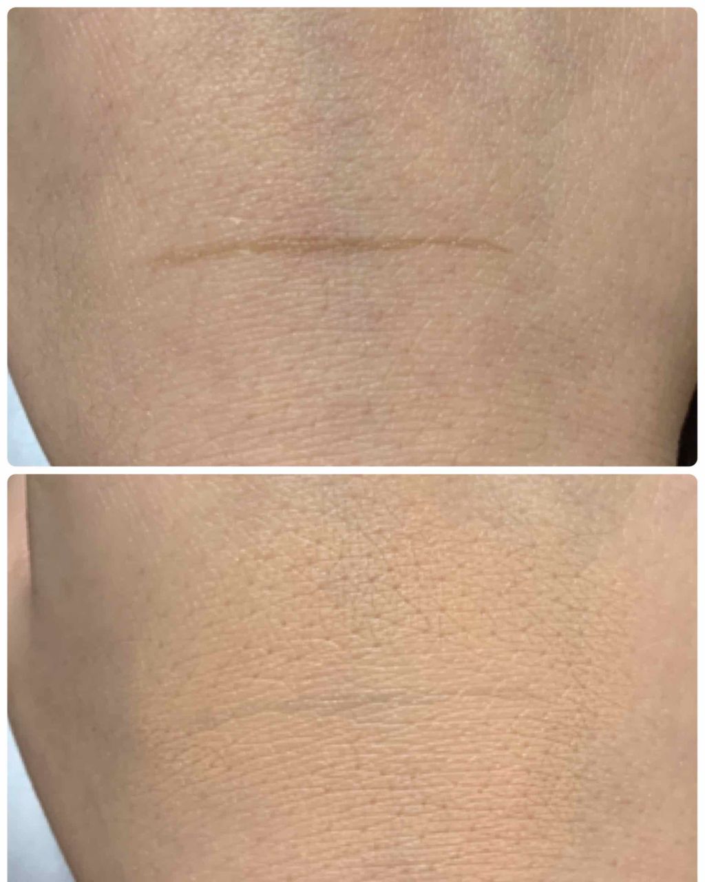 ホワイトルーセント オンメーキャップ スポッツコレクティング セラム/SHISEIDO/リキッドコンシーラーを使ったクチコミ（3枚目）