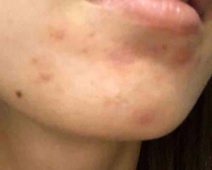 QuSomeモイスチャーリッチクリーム/b.glen/フェイスクリームを使ったクチコミ(1枚目)