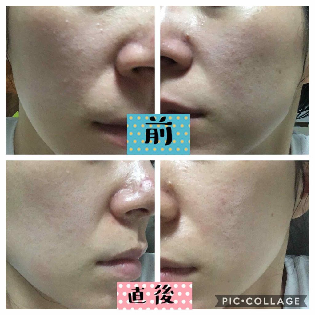 黒真珠マスク/我的美麗日記/シートマスク・パックを使ったクチコミ（3枚目）