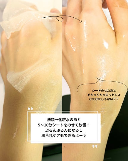 THE ティーツリー 365 カーミングマスク/MEDIHEAL/シートマスク・パックを使ったクチコミ(5枚目)