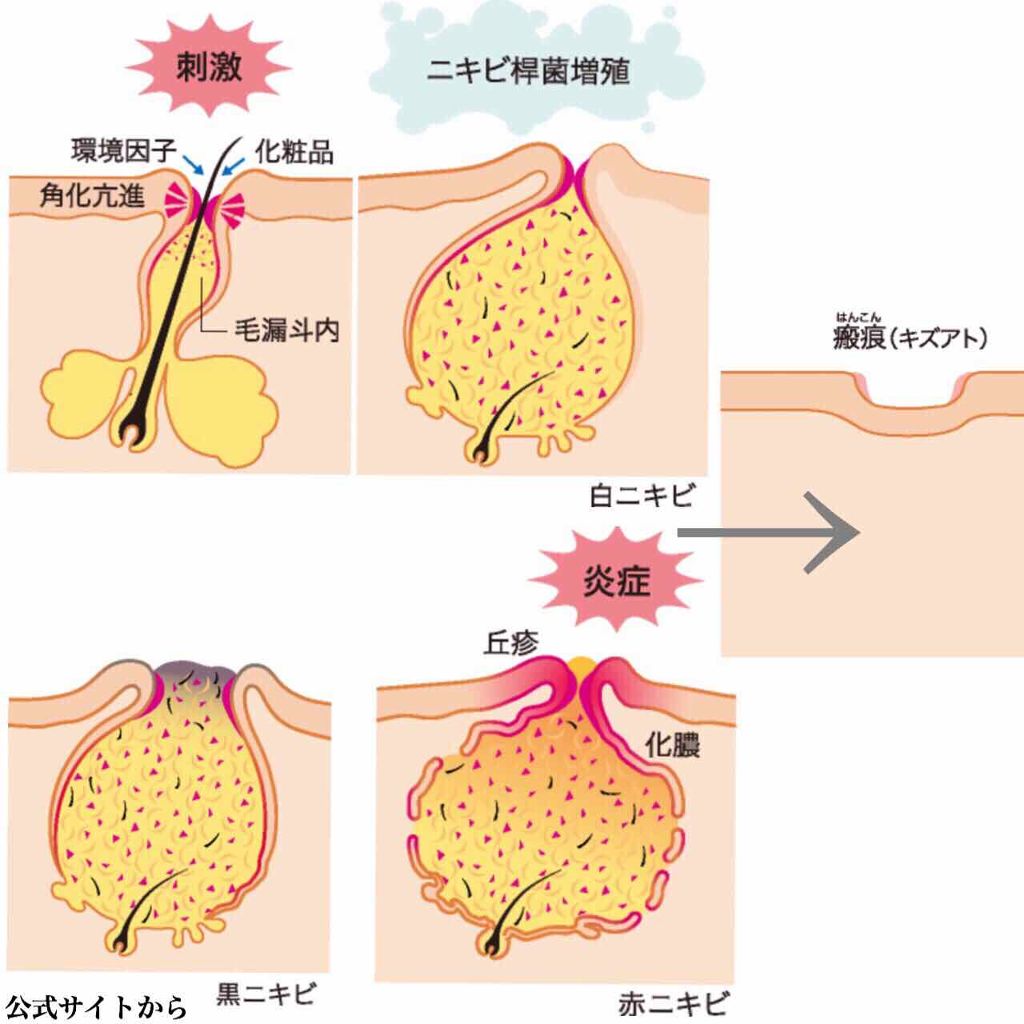 年間定番 クロロフィル美顔教室 パスター４個セット fawe.org