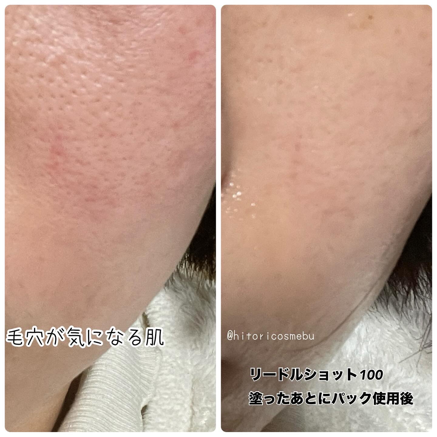 リードルS 100 2ステップマスク/VT/シートマスク・パックを使ったクチコミ（2枚目）