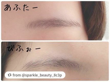 bi-hada ompa L ホルダー替刃2個付/貝印/シェーバーを使ったクチコミ(4枚目)