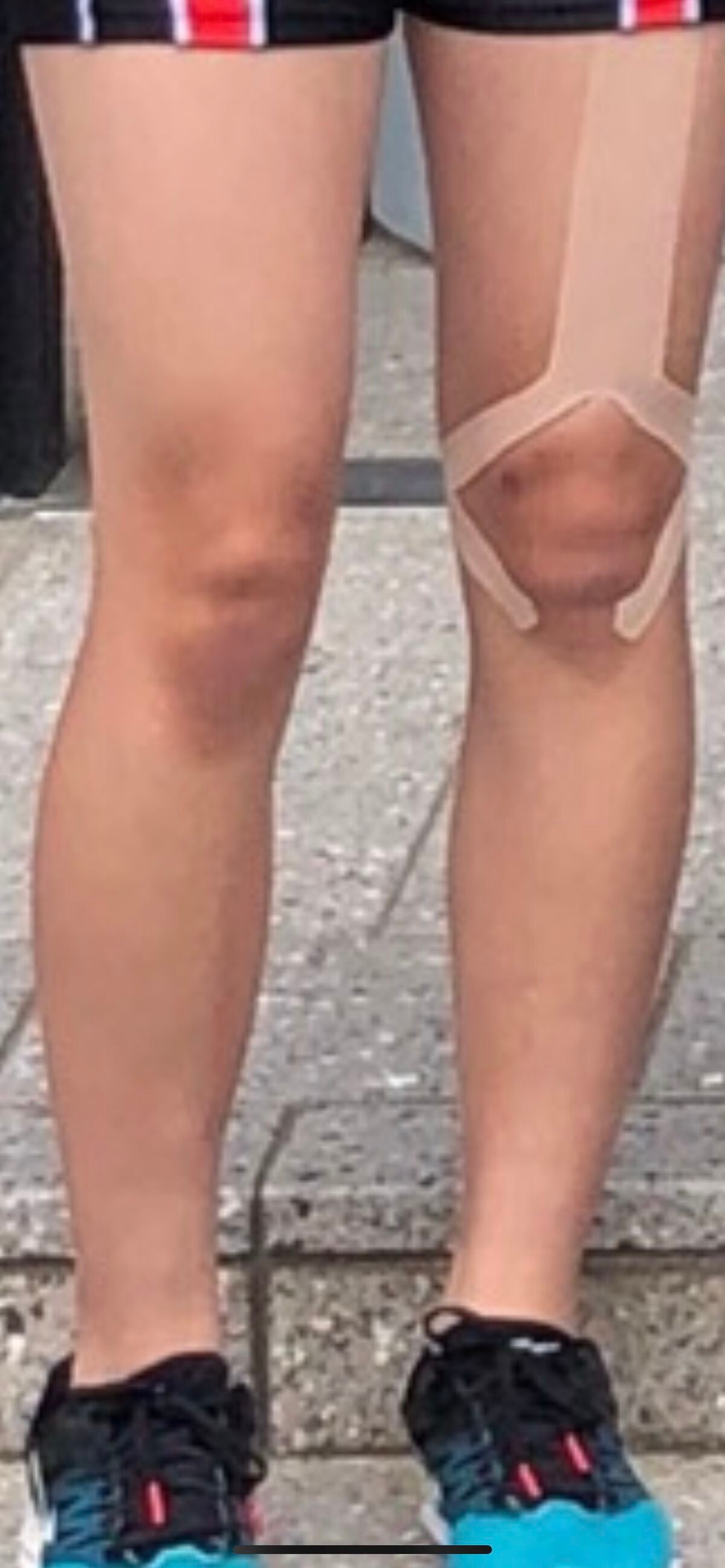 チョコラBBプラス (医薬品)/チョコラBB/その他を使ったクチコミ(2枚目)