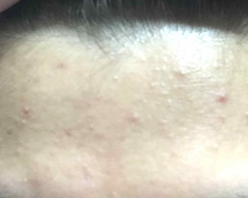 明色美顔水 薬用化粧水/美顔/化粧水を使ったクチコミ（3枚目）