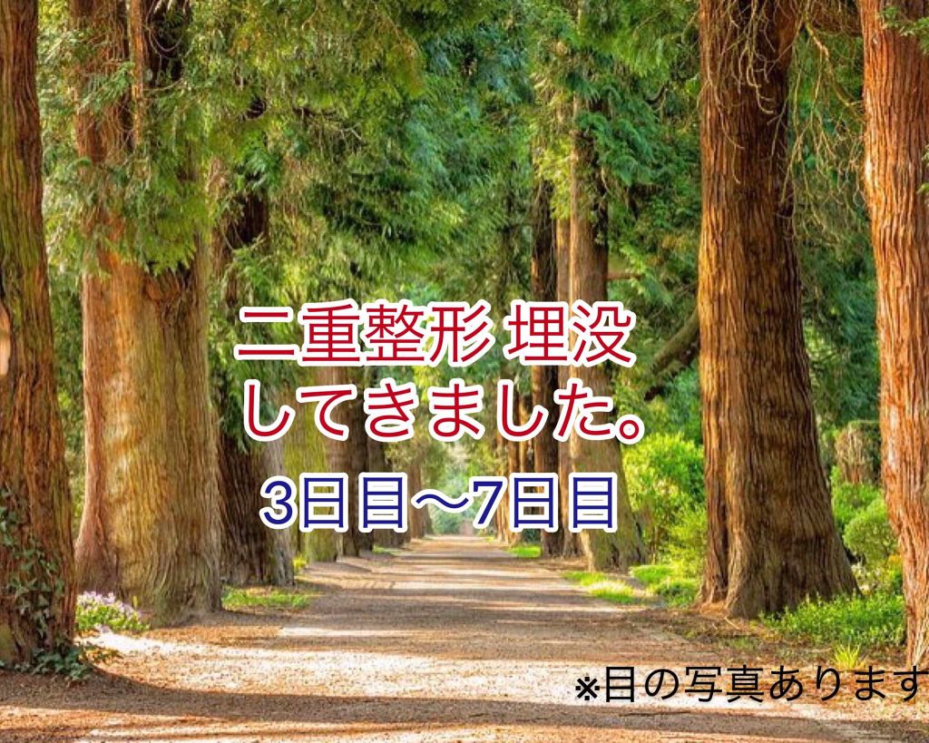 こはく on LIPS 「前回に引き続き、二重整形の話をしていきたいと思います。前回のに..」(1枚目)