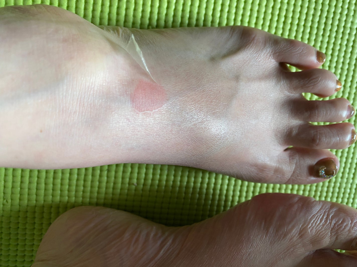 イージーパックSPT 30分タイプ/ベビーフット/レッグ・フットケアを使ったクチコミ(3枚目)