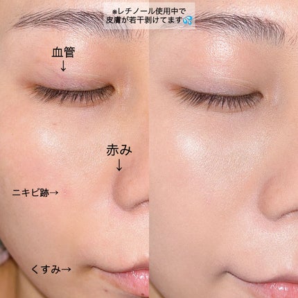 PROBIOエッセンスクッション/ネイチャーリパブリック/クッションファンデーションを使ったクチコミ(4枚目)