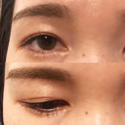 メジカルファイバー2/Automatic Beauty/二重まぶた用アイテムを使ったクチコミ(5枚目)