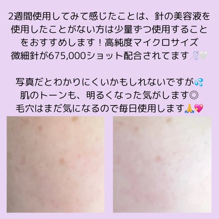 パンテショット675/COSNORI/美容液を使ったクチコミ(4枚目)