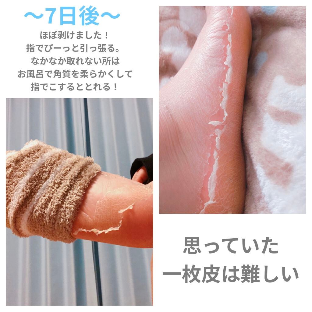 ベビーフット60分タイプ 北見ハッカコラボ品/ベビーフット/レッグ・フットケアを使ったクチコミ(8枚目)