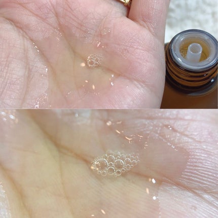 シーバムコントロールVCローションII/プリモディーネ/化粧水を使ったクチコミ(4枚目)