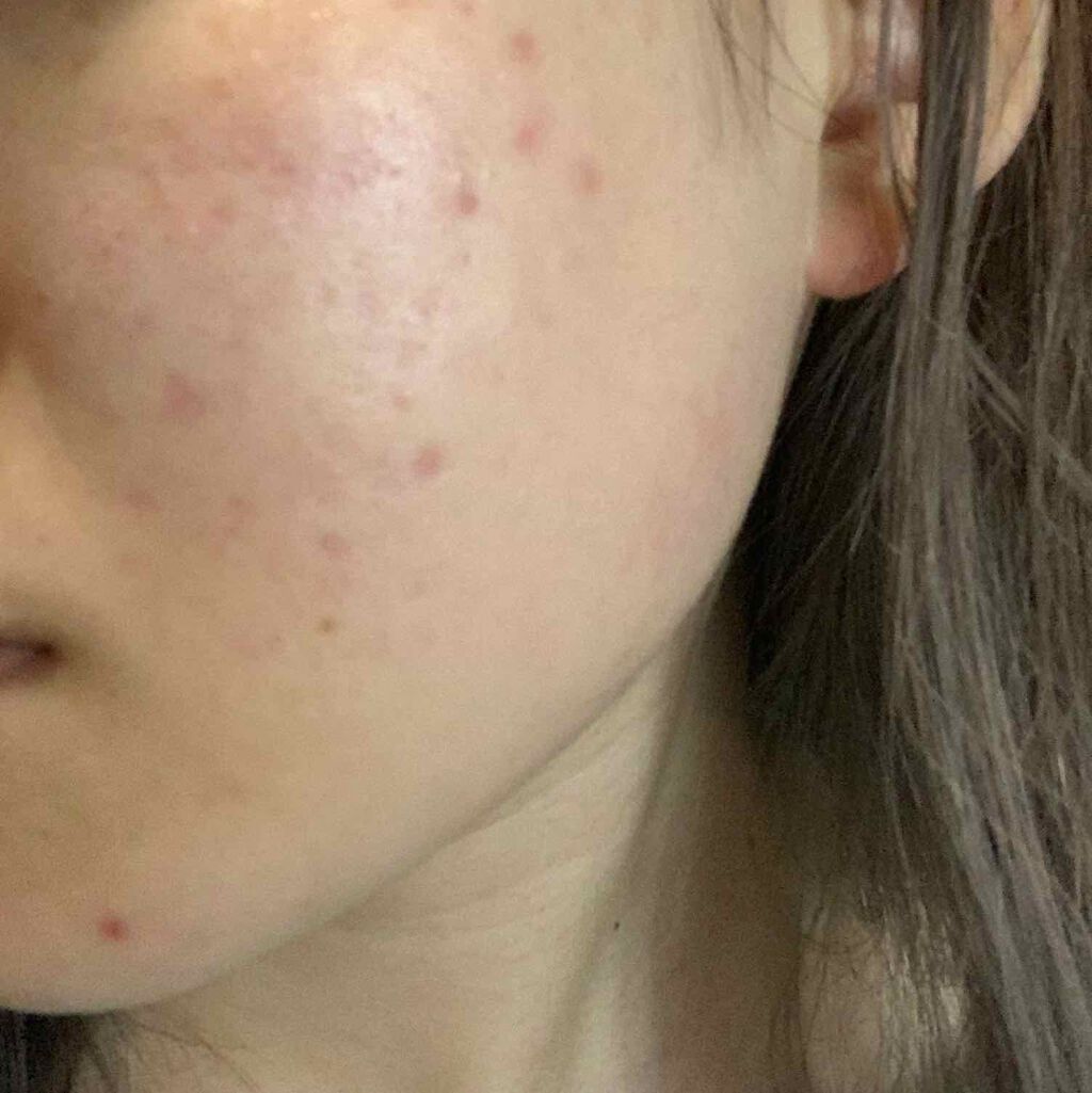 スンジョン トナー/ETUDE/化粧水を使ったクチコミ（2枚目）