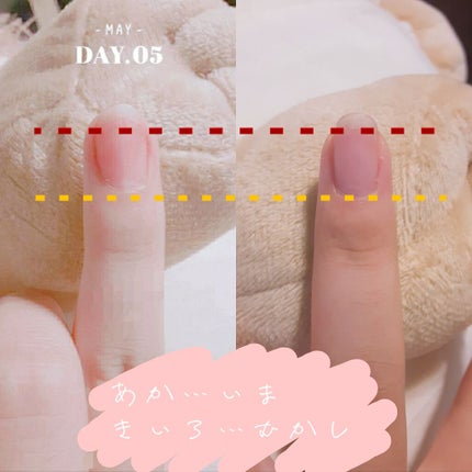 ネイルベッドオイル/アンドネイル/ネイルオイル・トリートメントを使ったクチコミ(1枚目)