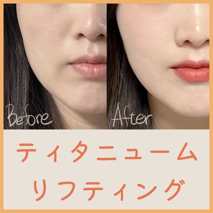 を使ったクチコミ(1枚目)