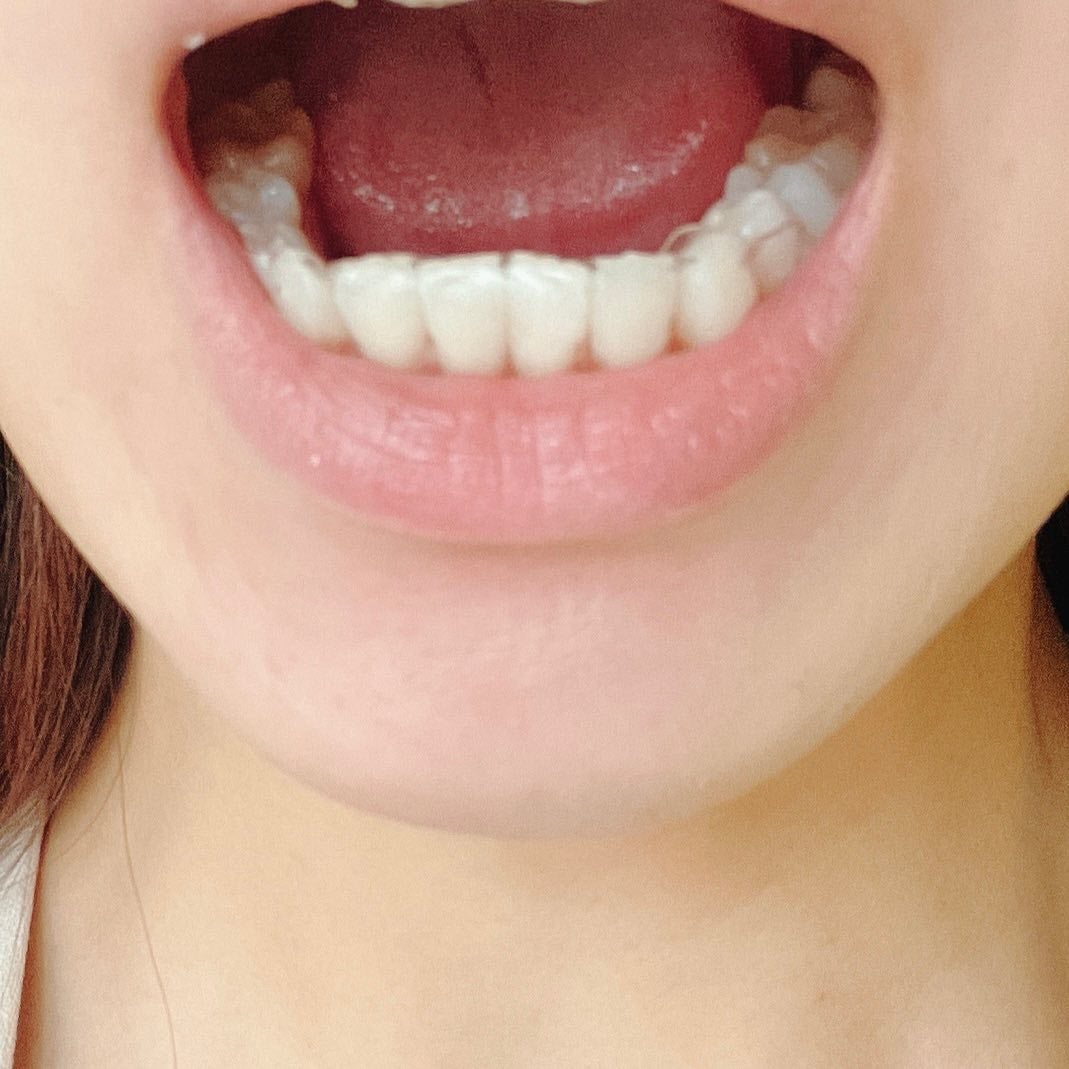 THE 歯の黄ばみ集中パック/武内製薬 THEシリーズ/その他オーラルケアを使ったクチコミ(6枚目)