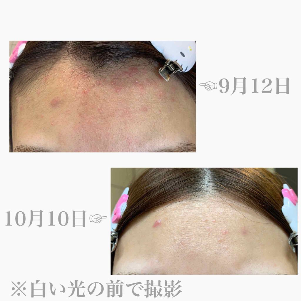 パワーマスク/ラッシュ/洗い流すパック・マスクを使ったクチコミ(5枚目)