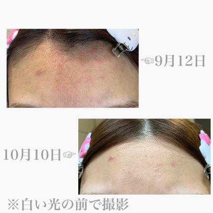 パワーマスク/ラッシュ/洗い流すパック・マスクを使ったクチコミ(5枚目)