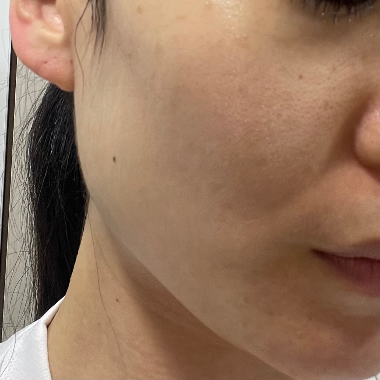 ダーマテカバイオームクリーム/THE A'VVE/フェイスクリームを使ったクチコミ(3枚目)