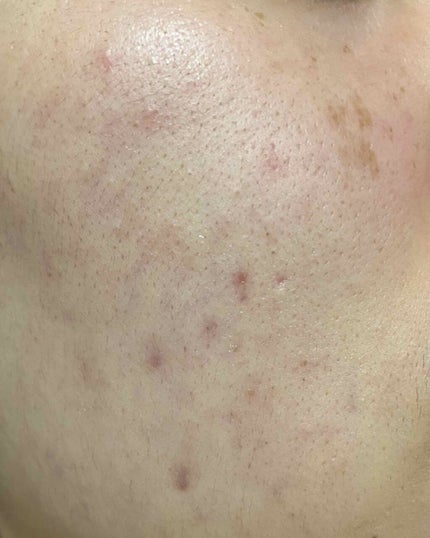 ハトムギ洗顔フォーム/株式会社イヴ/洗顔フォームを使ったクチコミ(2枚目)