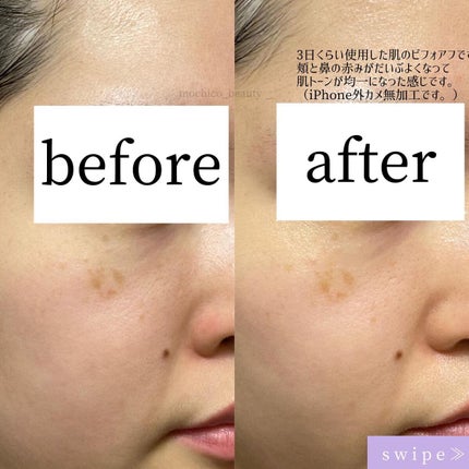 もちこ | 元エステティシャン | 気になった方フォロバ on LIPS 「7日後には変化を感じれちゃう⁉︎ビタDペア♡💄……………………..」(7枚目)