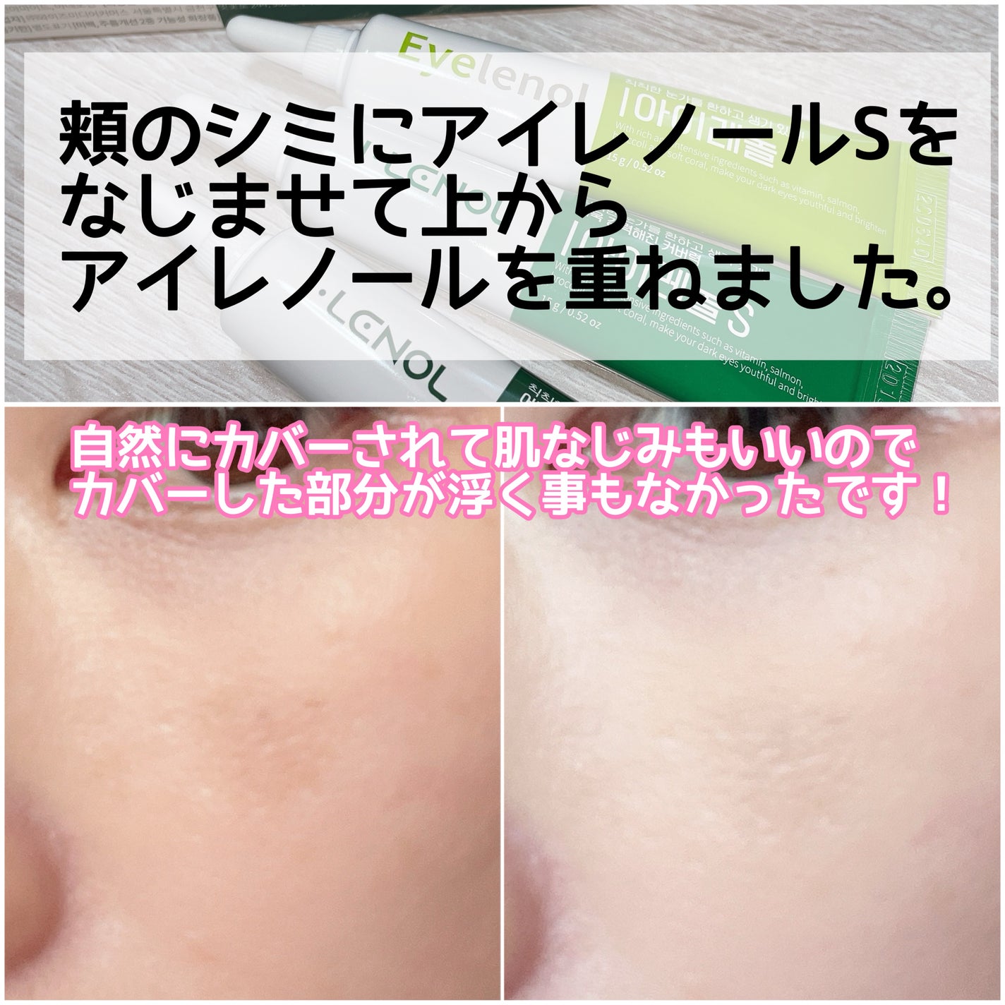 アイレノール クマクリーム/IRENOL/アイケア・アイクリームを使ったクチコミ(4枚目)