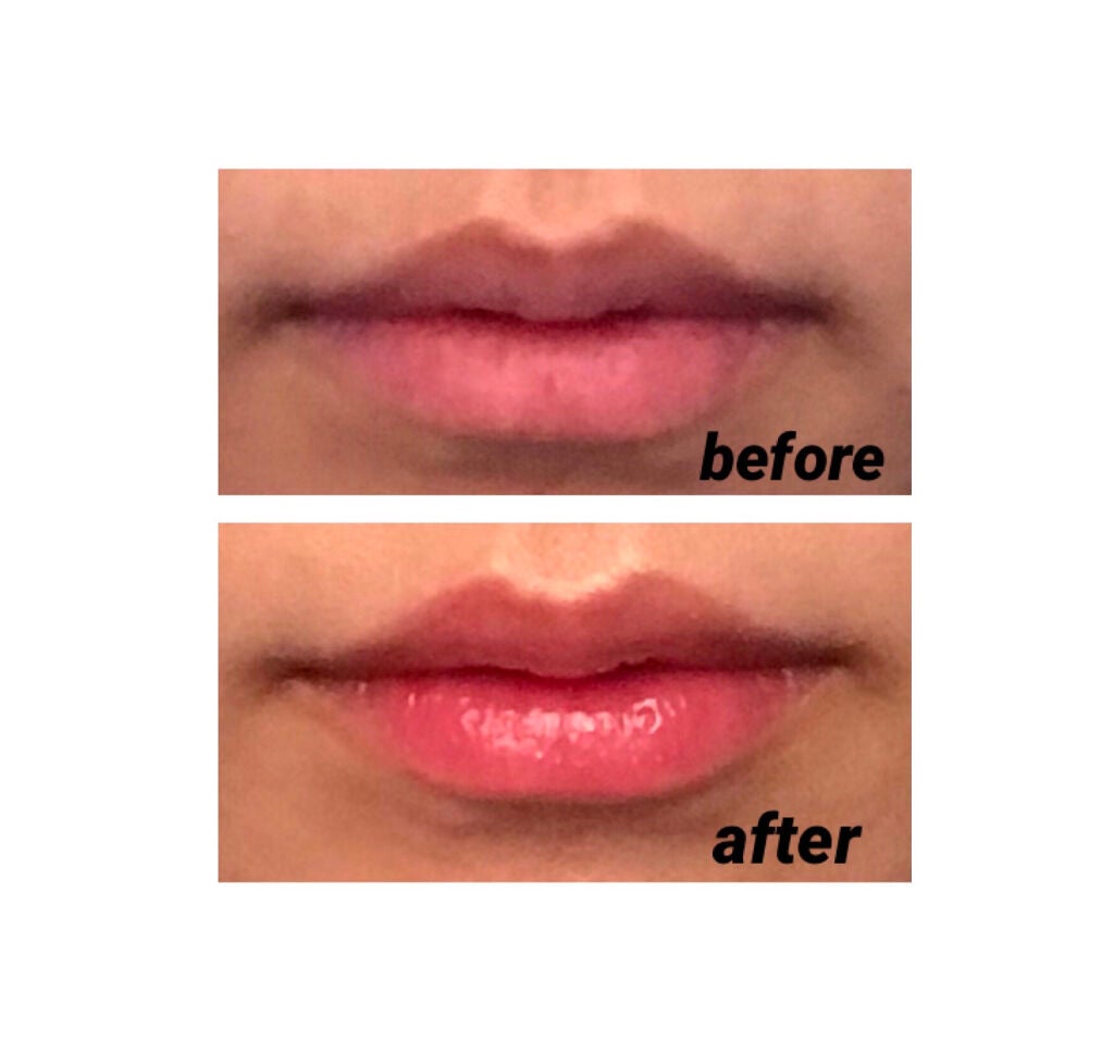 38°C / 99°F リップトリートメント (リップ美容液)/UZU BY FLOWFUSHI/リップケアを使ったクチコミ(2枚目)