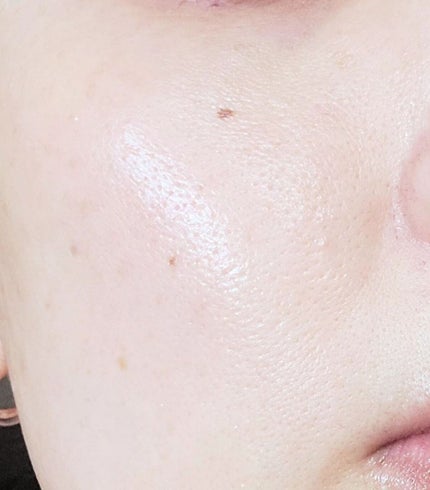 桃70%ナイアシンセラム/Anua/美容液を使ったクチコミ(6枚目)