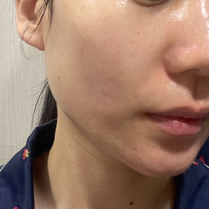 米エキス 保湿クリーム/HANYUL(ハンユル)/フェイスクリームを使ったクチコミ(4枚目)