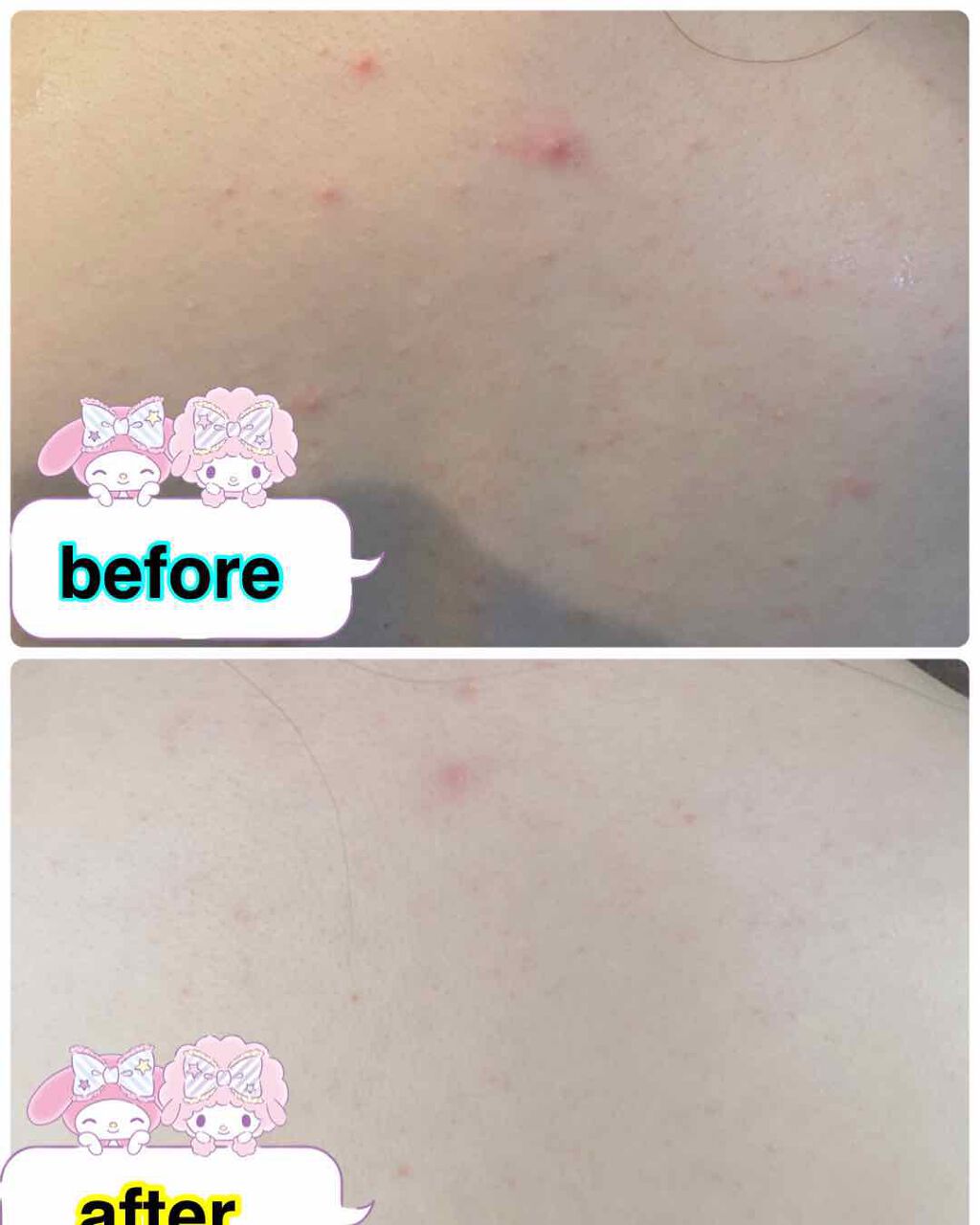 のびのびボディーネット/無印良品/バスグッズを使ったクチコミ（3枚目）