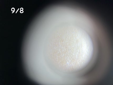 リードルショット300/VT/美容液を使ったクチコミ(6枚目)