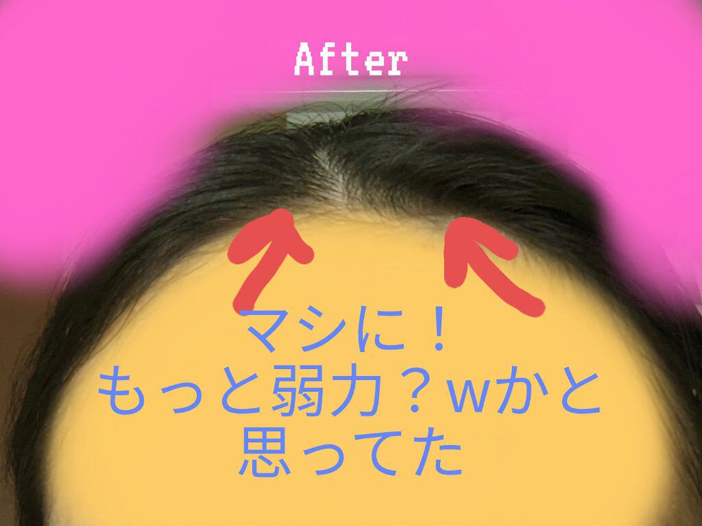 まとめ髪スティック スーパーホールド/マトメージュ/ヘアワックス・クリームを使ったクチコミ（3枚目）