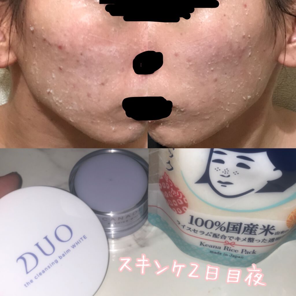 デュオ ザ クレンジングバーム ホワイトa/DUO/クレンジングバームを使ったクチコミ（1枚目）