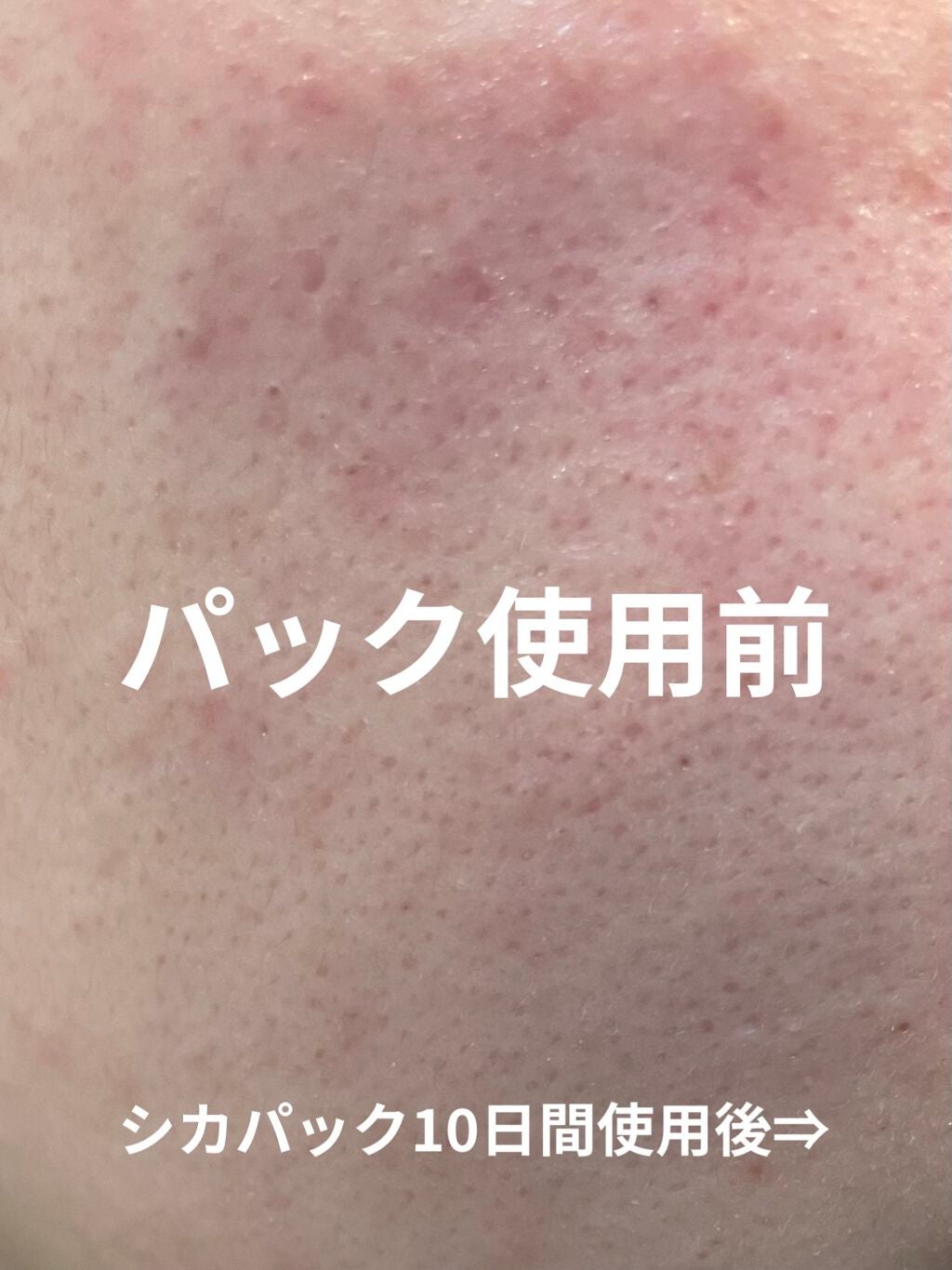 ハトムギ化粧水(ナチュリエ スキンコンディショナー R )/ナチュリエ/化粧水を使ったクチコミ(1枚目)