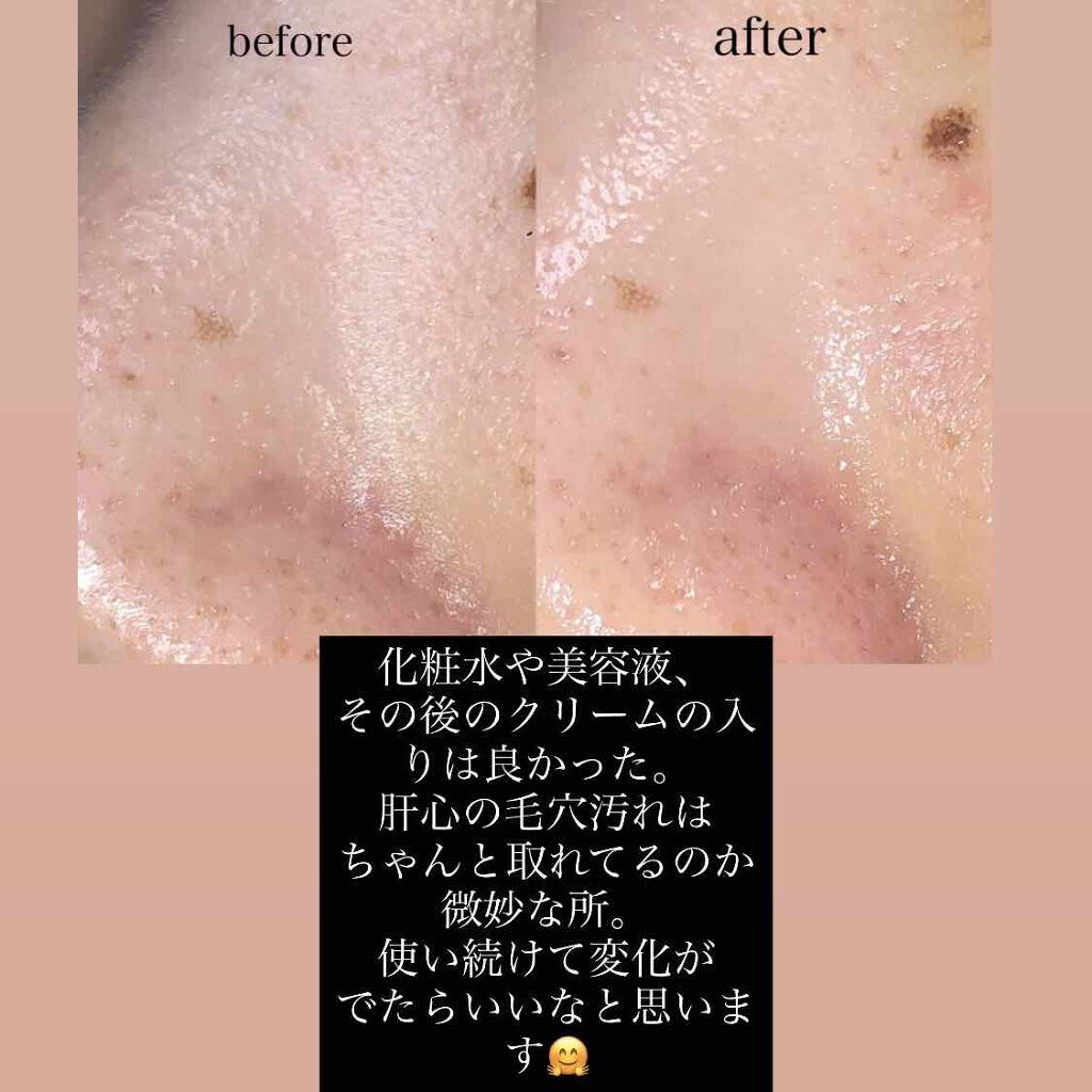 イオンクレンズ/Bellcida/美顔器・マッサージを使ったクチコミ(2枚目)